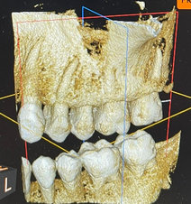 A 3D picture of teeth